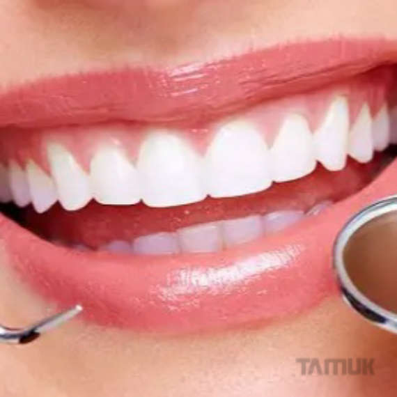 دندانپزشكی زیبایی